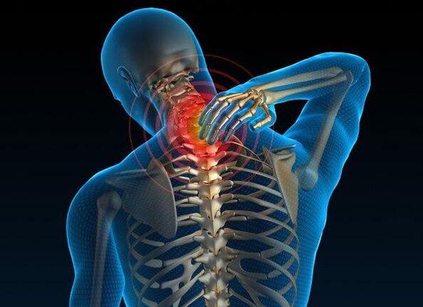 a nyaki régió súlyos osteochondrosisa